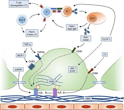 Autoimmunity in Focal Segmental Glomerulosclerosis: A Long-Standing Yet Elusive Association